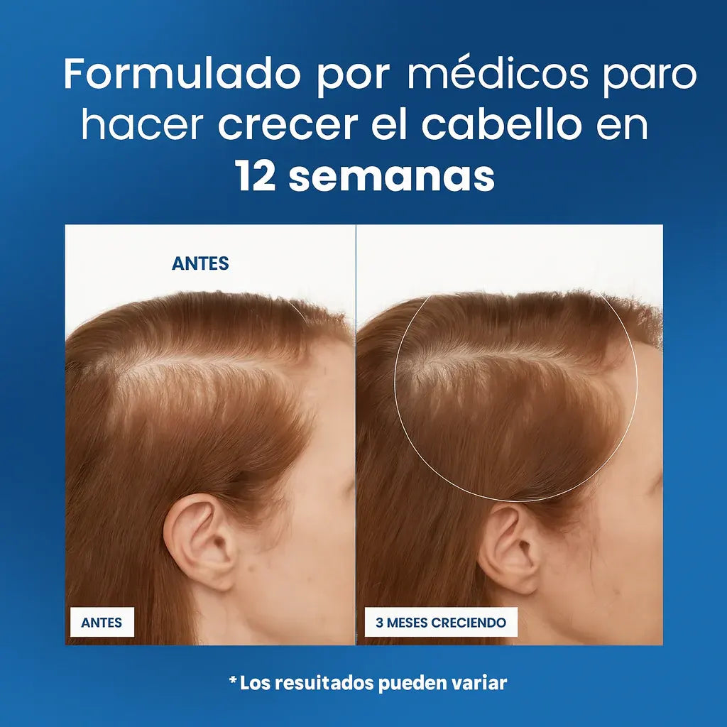 BodyWise Hair Growth - Sérum Capilar Anticaída y Crecimiento Intensivo