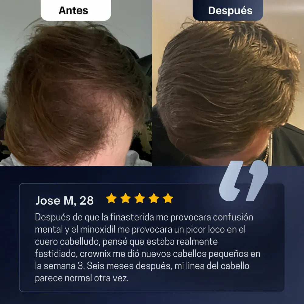 BodyWise Hair Growth - Sérum Capilar Anticaída y Crecimiento Intensivo